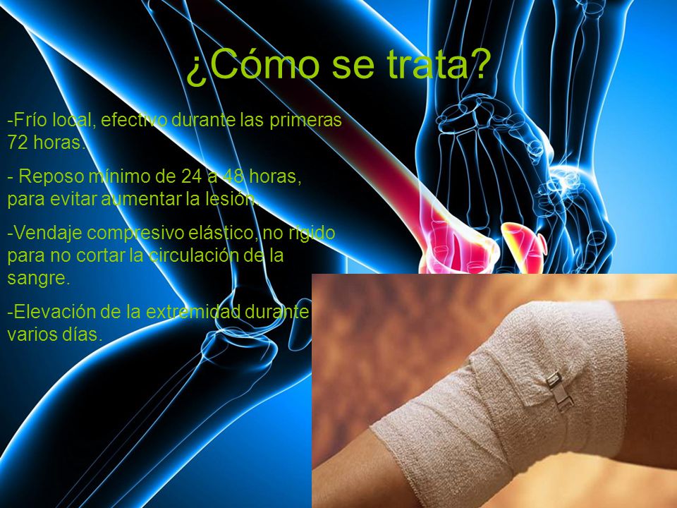 ¿Cómo se trata Frío local, efectivo durante las primeras 72 horas.