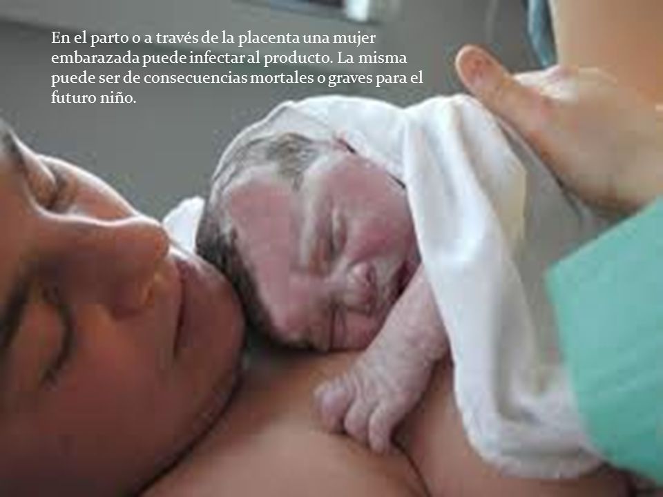 En el parto o a través de la placenta una mujer embarazada puede infectar al producto.