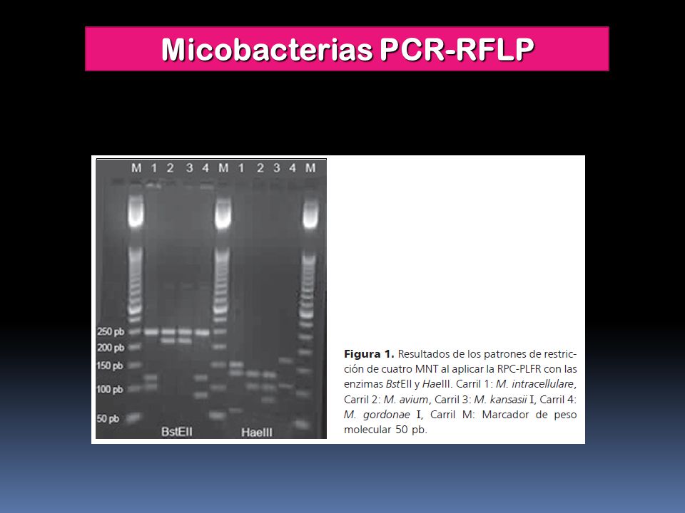 Micobacterias PCR-RFLP