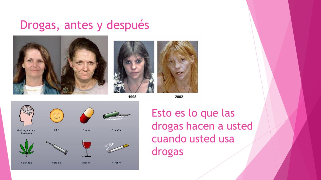 Drogas, antes y después Esto es lo que las drogas hacen a usted cuando usted usa drogas