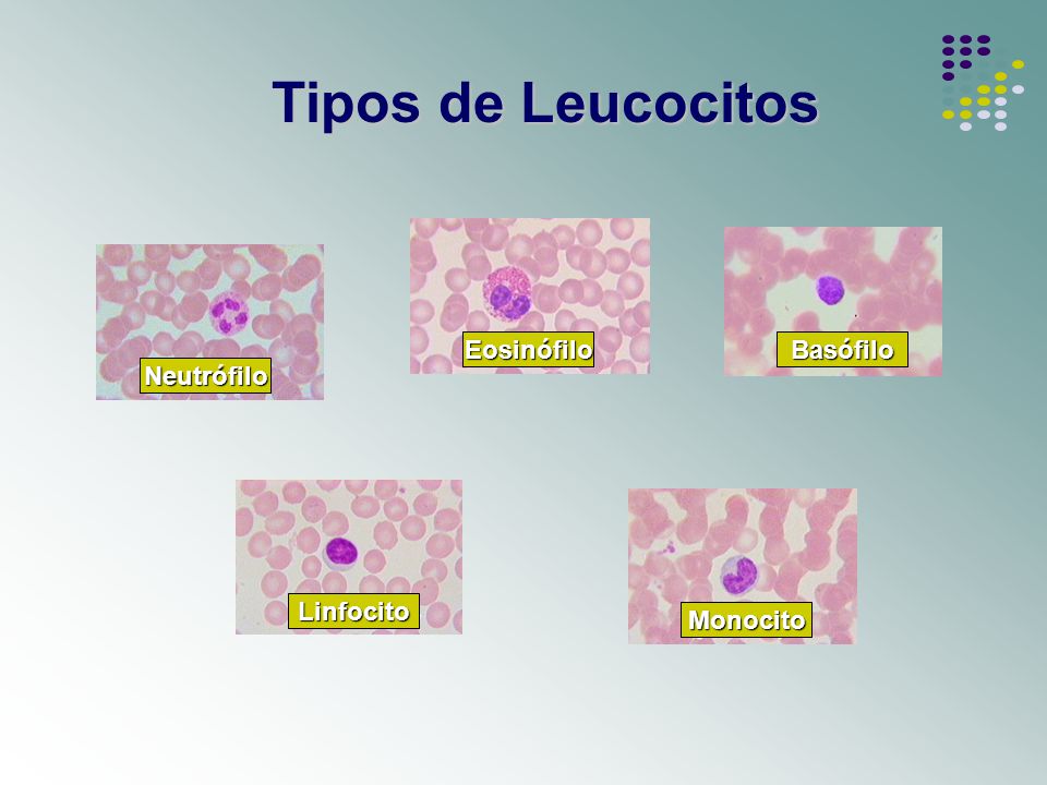 Tipos de Leucocitos Eosinófilo Eosinófilo Basófilo Neutrófilo