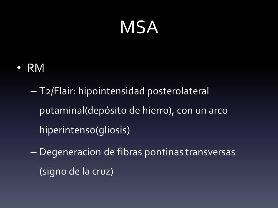 MSA RM. T2/Flair: hipointensidad posterolateral putaminal(depósito de hierro), con un arco hiperintenso(gliosis)