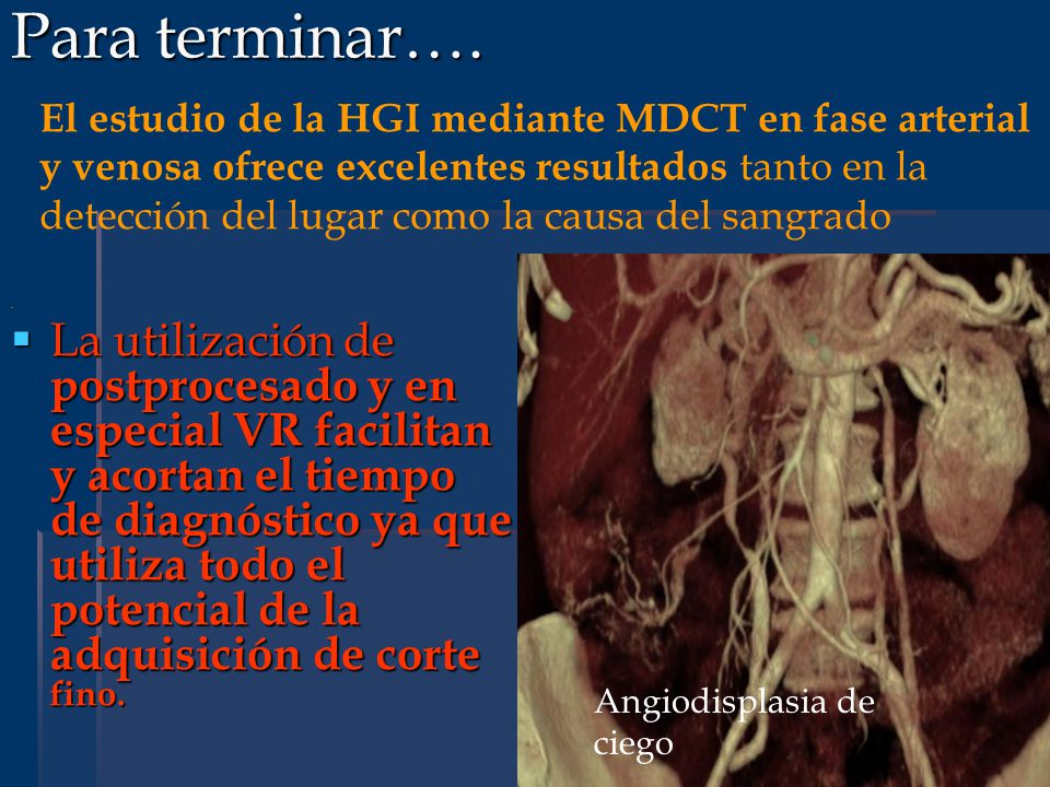 Para terminar….