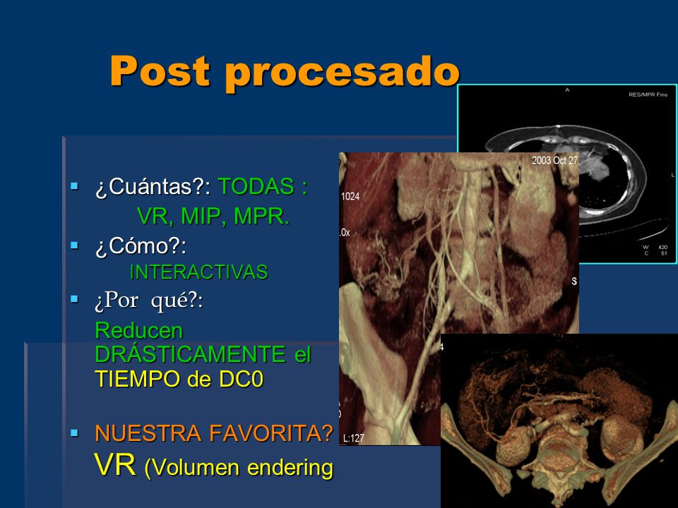 Post procesado ¿Cuántas : TODAS : VR, MIP, MPR. ¿Cómo : ¿Por qué :