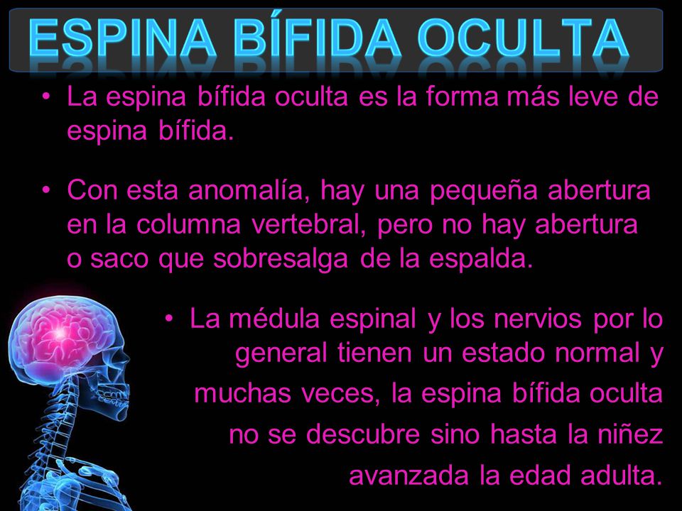Espina Bífida oculta La espina bífida oculta es la forma más leve de espina bífida.