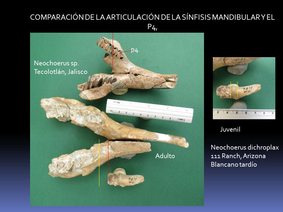 COMPARACIÓN DE LA ARTICULACIÓN DE LA SÍNFISIS MANDIBULAR Y EL P4,