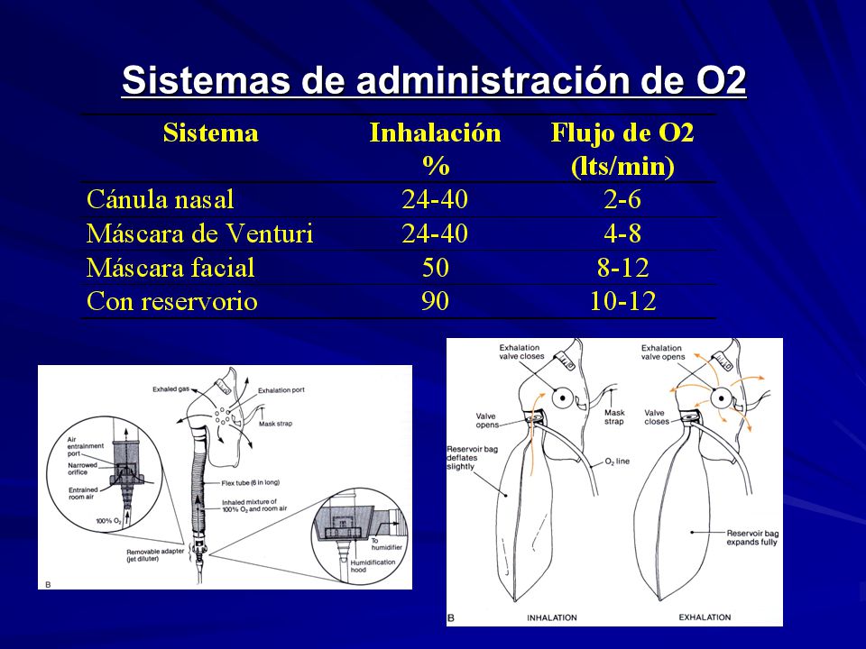 Sistemas de administración de O2