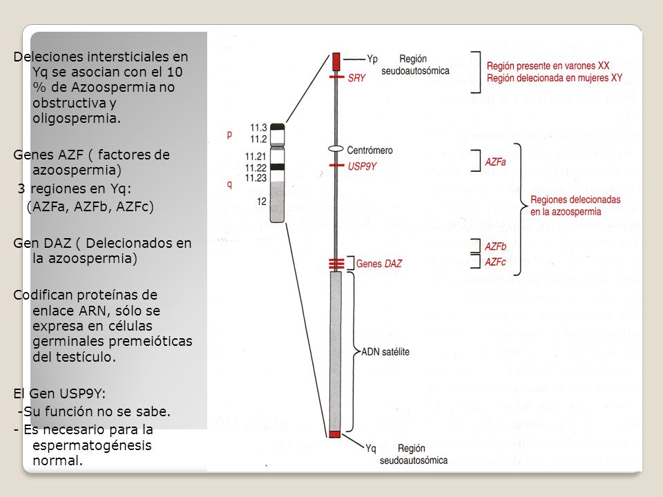 Deleciones intersticiales en Yq se asocian con el 10 % de Azoospermia no obstructiva y oligospermia.