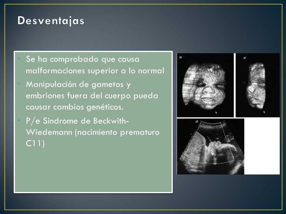 Desventajas Se ha comprobado que causa malformaciones superior a lo normal.