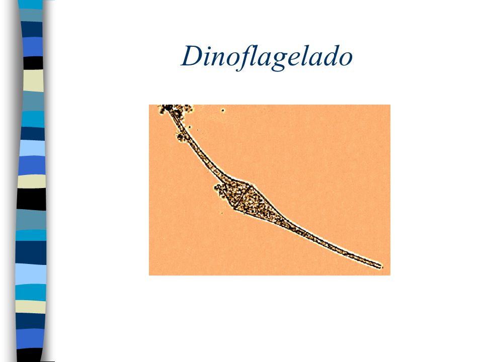 Dinoflagelado