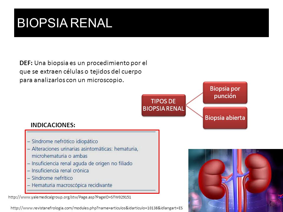 BIOPSIA RENAL DEF: Una biopsia es un procedimiento por el que se extraen células o tejidos del cuerpo para analizarlos con un microscopio.