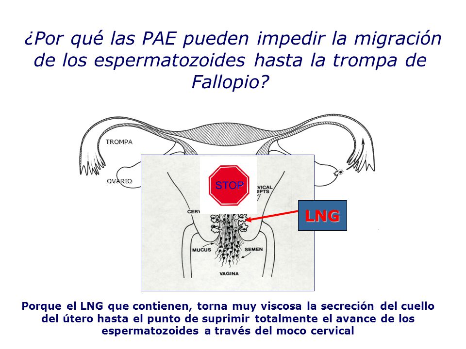 ¿Por qué las PAE pueden impedir la migración de los espermatozoides hasta la trompa de Fallopio