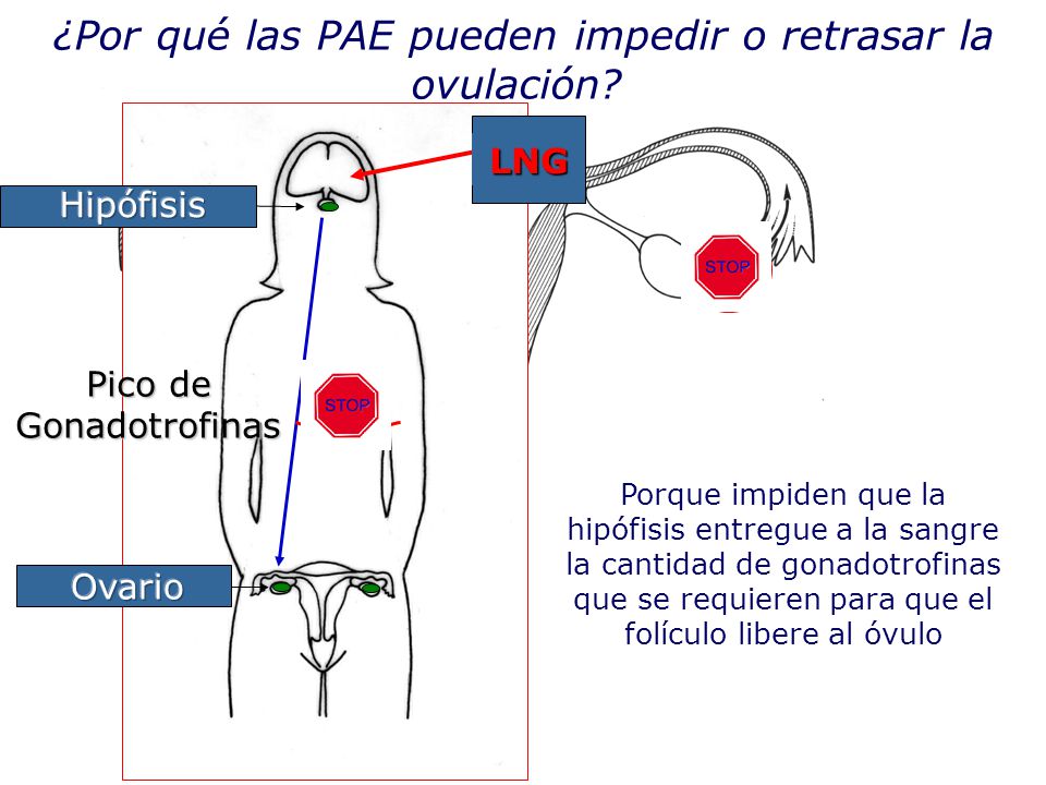 ¿Por qué las PAE pueden impedir o retrasar la ovulación