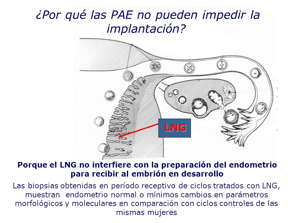 ¿Por qué las PAE no pueden impedir la implantación