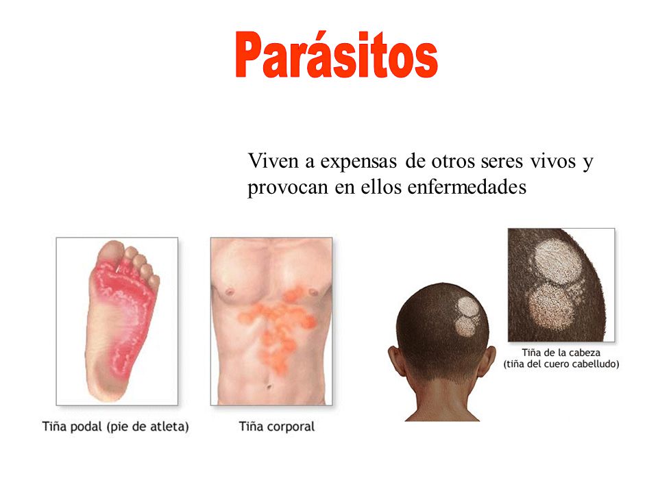 Parásitos Viven a expensas de otros seres vivos y provocan en ellos enfermedades