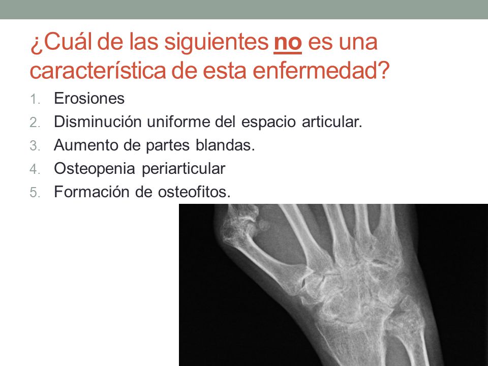 ¿Cuál de las siguientes no es una característica de esta enfermedad
