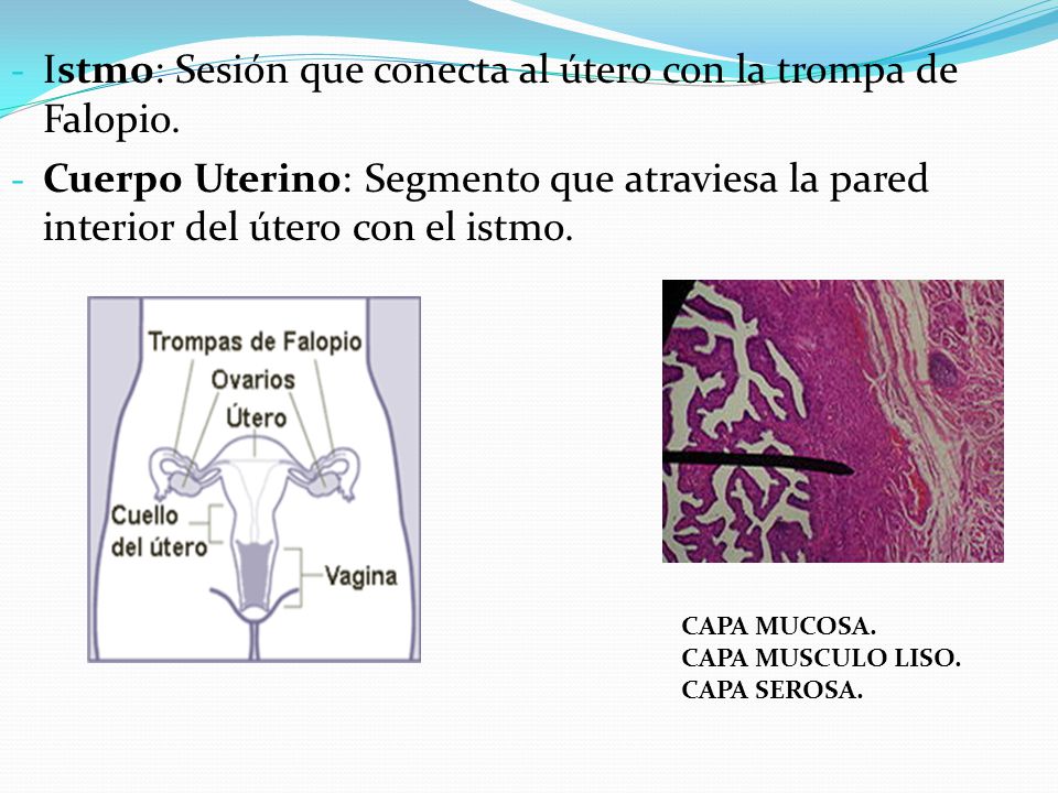 Istmo: Sesión que conecta al útero con la trompa de Falopio.