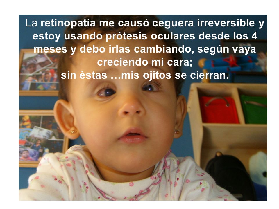 La retinopatía me causó ceguera irreversible y estoy usando prótesis oculares desde los 4 meses y debo irlas cambiando, según vaya creciendo mi cara; sin èstas …mis ojitos se cierran.