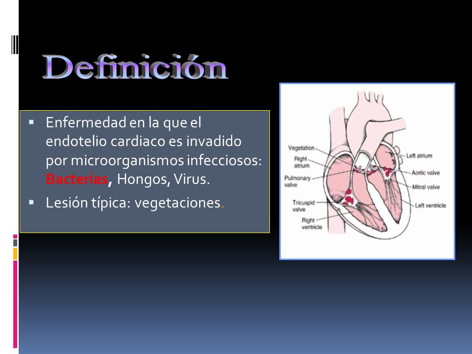 Definición Enfermedad en la que el endotelio cardiaco es invadido por microorganismos infecciosos: Bacterias, Hongos, Virus.