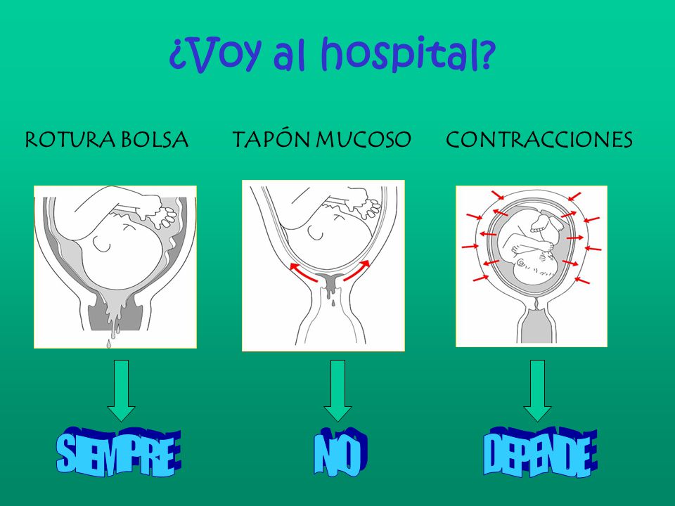 ¿Voy al hospital ROTURA BOLSA TAPÓN MUCOSO CONTRACCIONES SIEMPRE NO