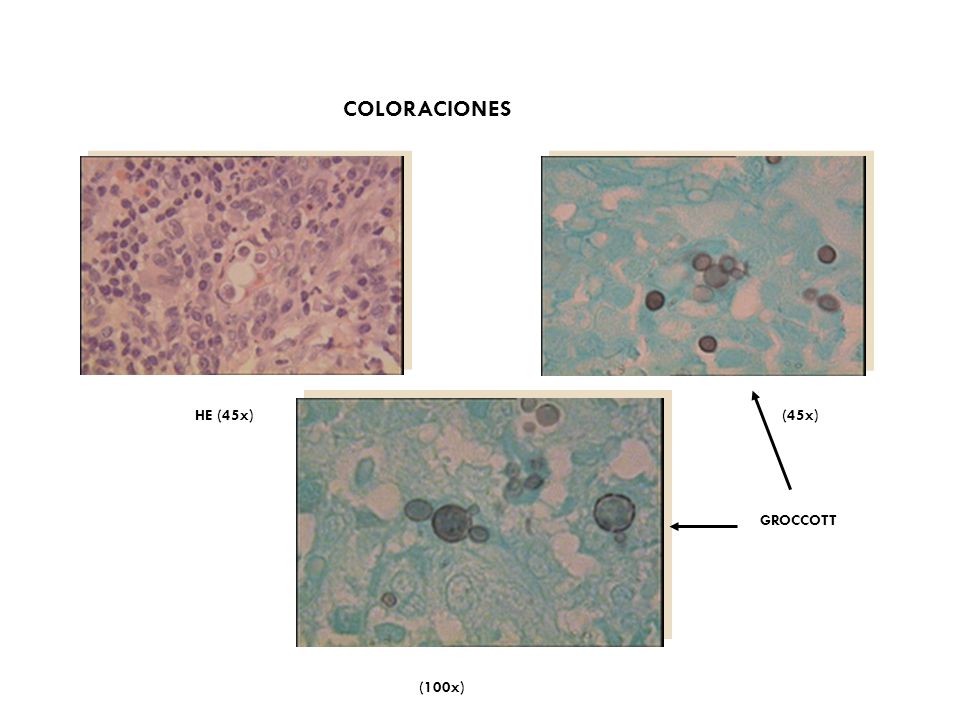 COLORACIONES HE (45x) (45x) GROCCOTT (100x)