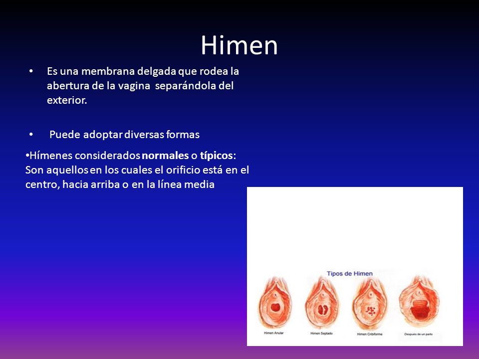 Hymen Buster