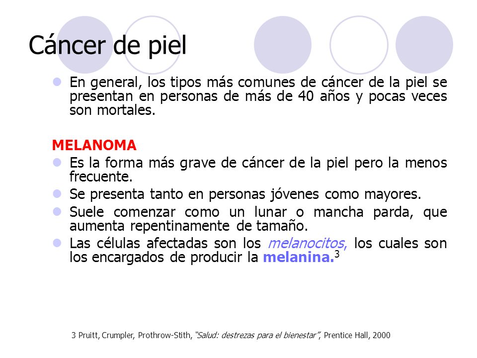 Cáncer de piel En general, los tipos más comunes de cáncer de la piel se presentan en personas de más de 40 años y pocas veces son mortales.