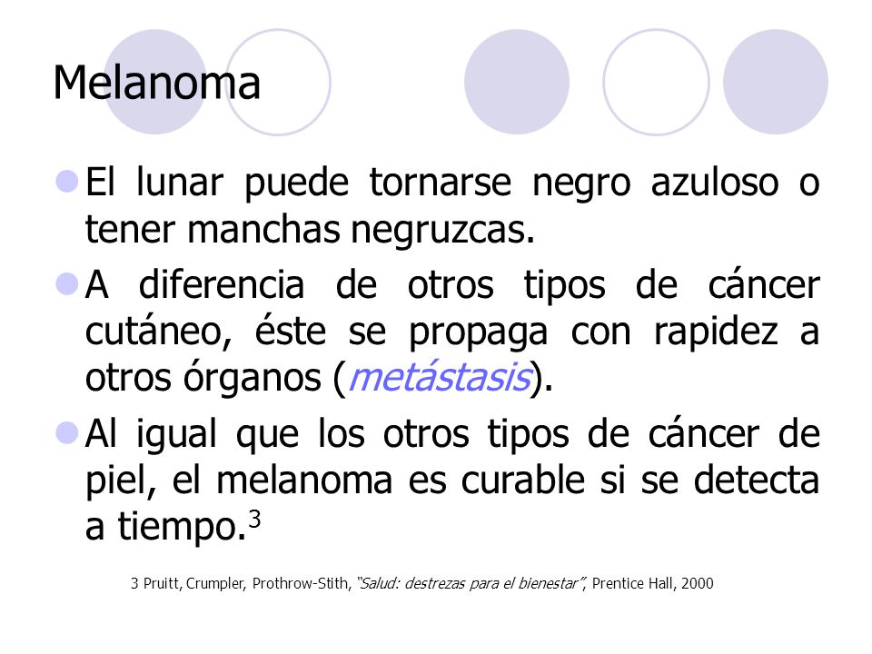Melanoma El lunar puede tornarse negro azuloso o tener manchas negruzcas.