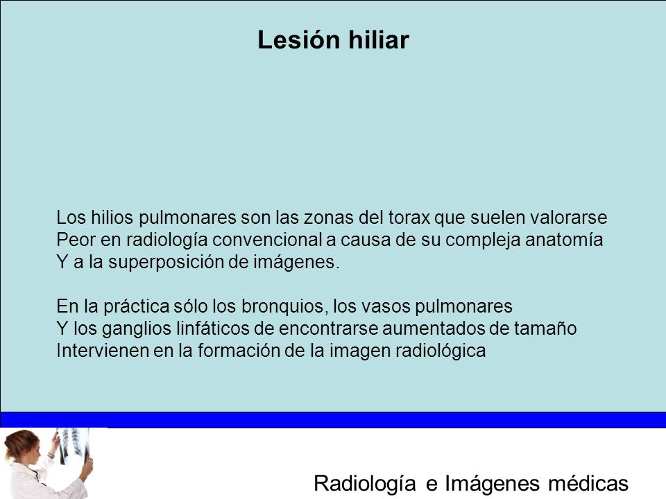 Lesión hiliar Los hilios pulmonares son las zonas del torax que suelen valorarse. Peor en radiología convencional a causa de su compleja anatomía.