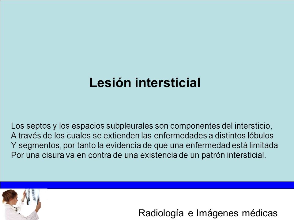 Lesión intersticial Los septos y los espacios subpleurales son componentes del intersticio,