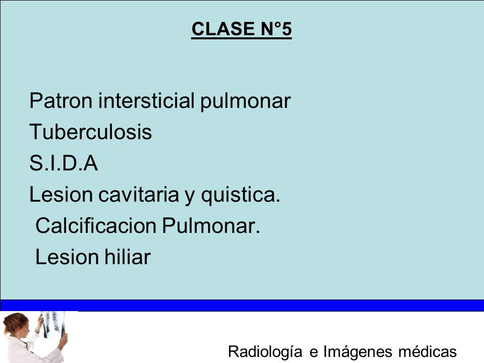 CLASE N°5 Patron intersticial pulmonar Tuberculosis S.I.D.A Lesion cavitaria y quistica.