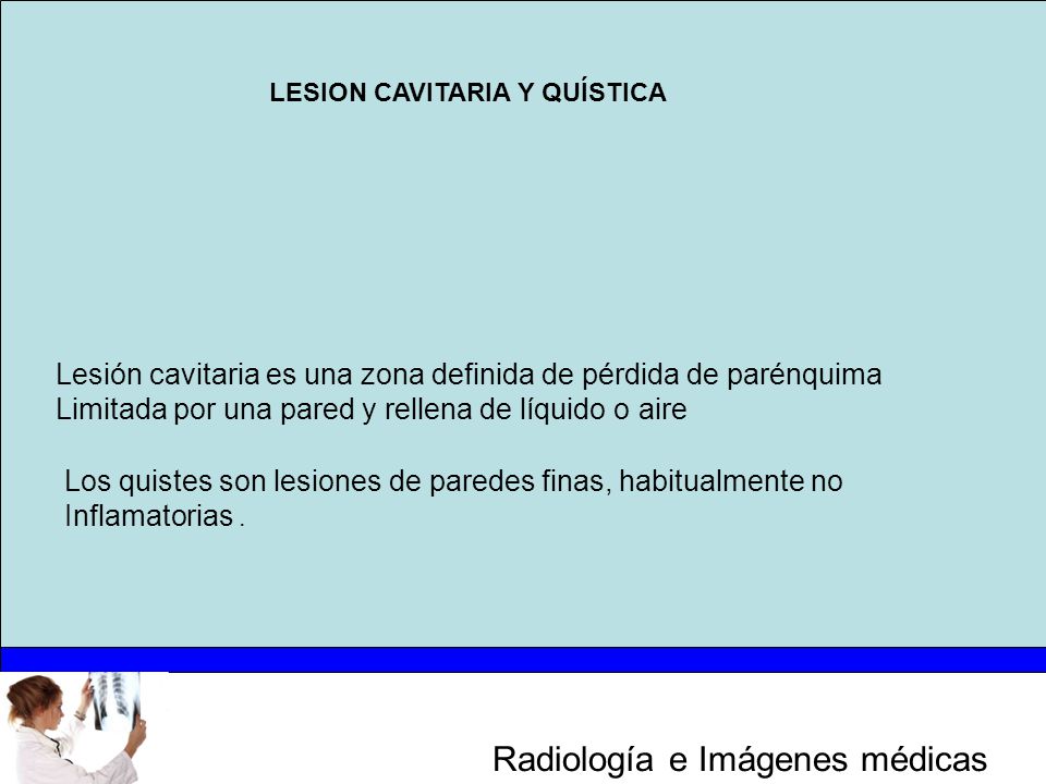 Lesión cavitaria es una zona definida de pérdida de parénquima