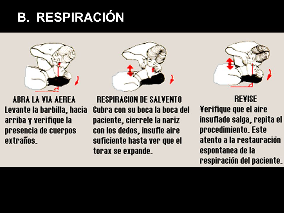 M Mire si respira E Escuche si respira S Sienta si respira RESPIRACIÓN