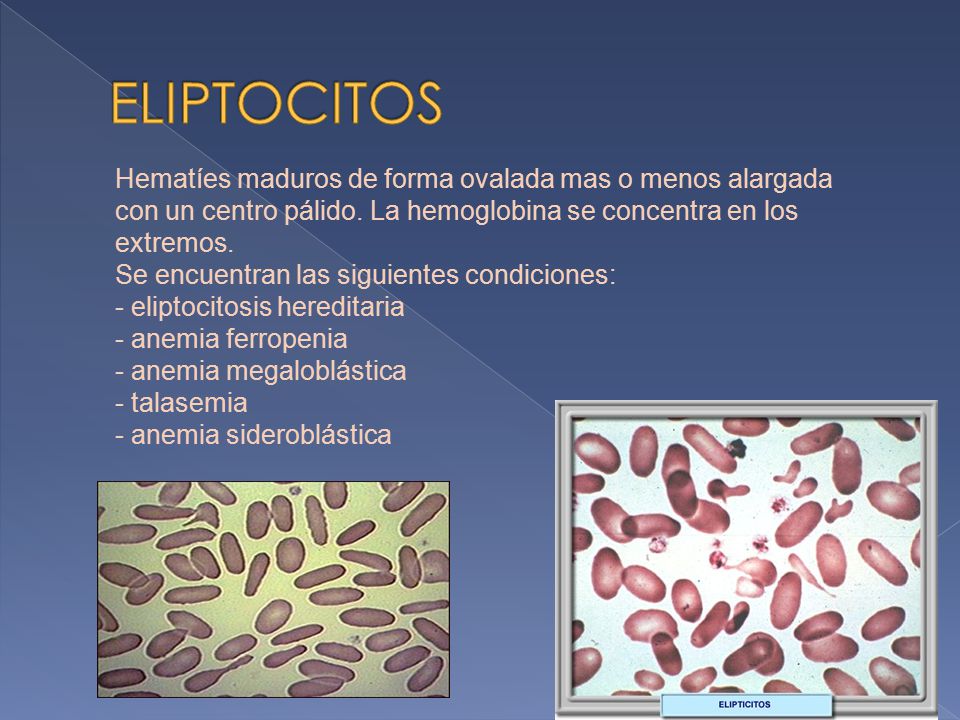 ELIPTOCITOS Hematíes maduros de forma ovalada mas o menos alargada con un centro pálido. La hemoglobina se concentra en los extremos.