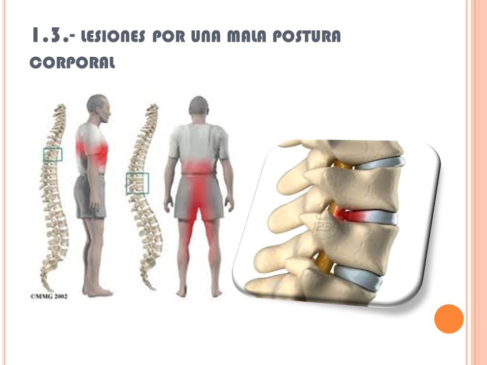 1.3.- lesiones por una mala postura corporal