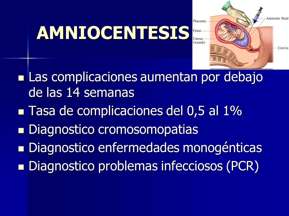 AMNIOCENTESIS Las complicaciones aumentan por debajo de las 14 semanas