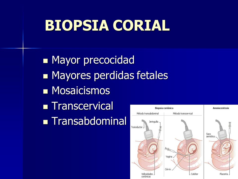 BIOPSIA CORIAL Mayor precocidad Mayores perdidas fetales Mosaicismos