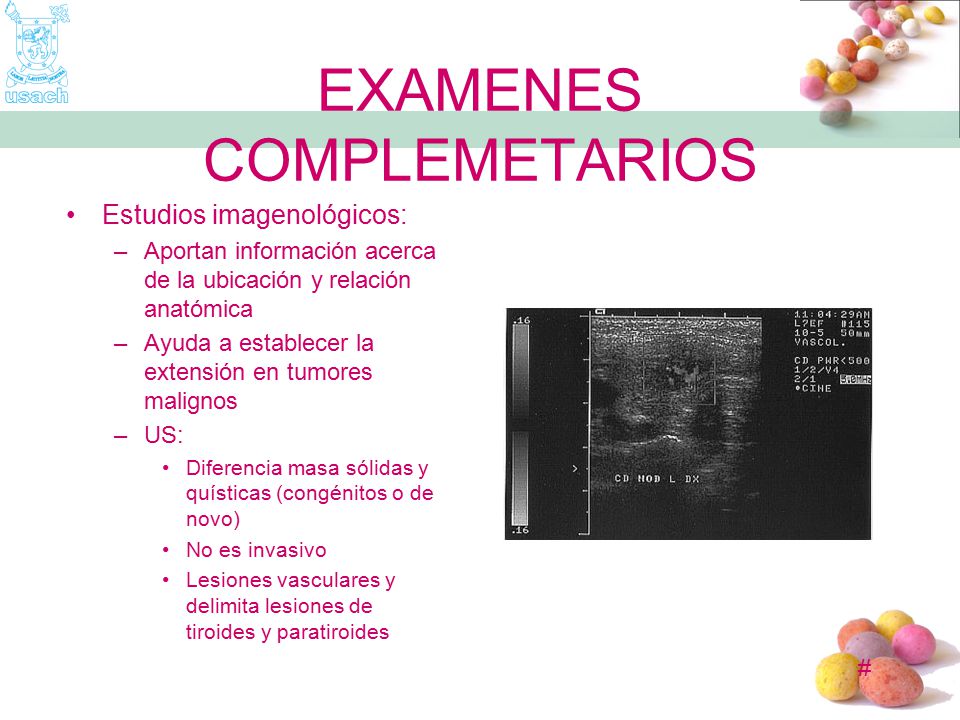 EXAMENES COMPLEMETARIOS