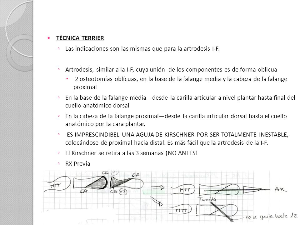 TÉCNICA TERRIER Las indicaciones son las mismas que para la artrodesis I-F.