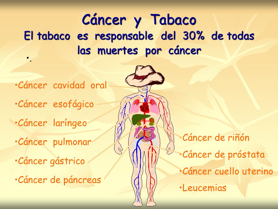 Cáncer y Tabaco El tabaco es responsable del 30% de todas las muertes por cáncer