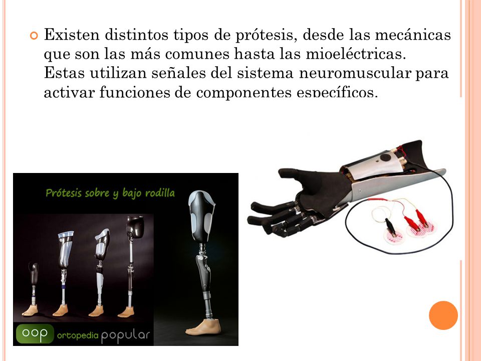 Existen distintos tipos de prótesis, desde las mecánicas que son las más comunes hasta las mioeléctricas.