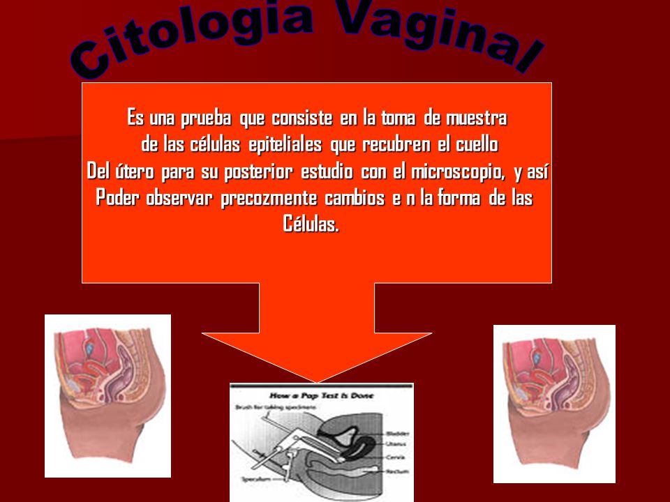 Citologia Vaginal Es una prueba que consiste en la toma de muestra