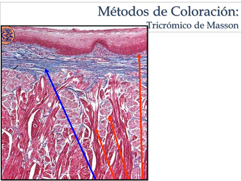 Métodos de Coloración: