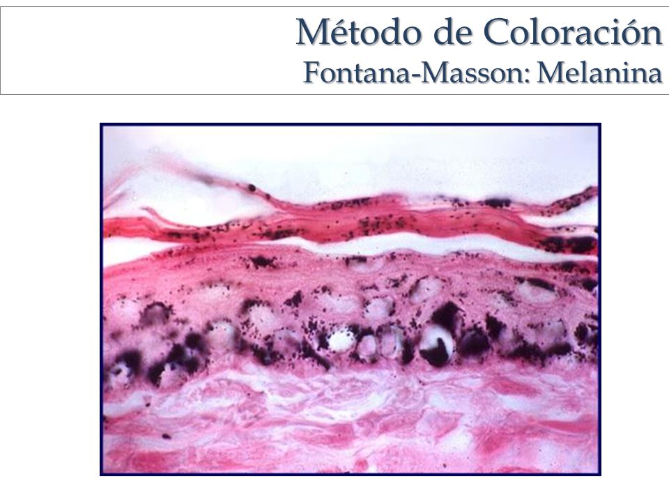 Método de Coloración Fontana-Masson: Melanina Fontana Masson: melanina