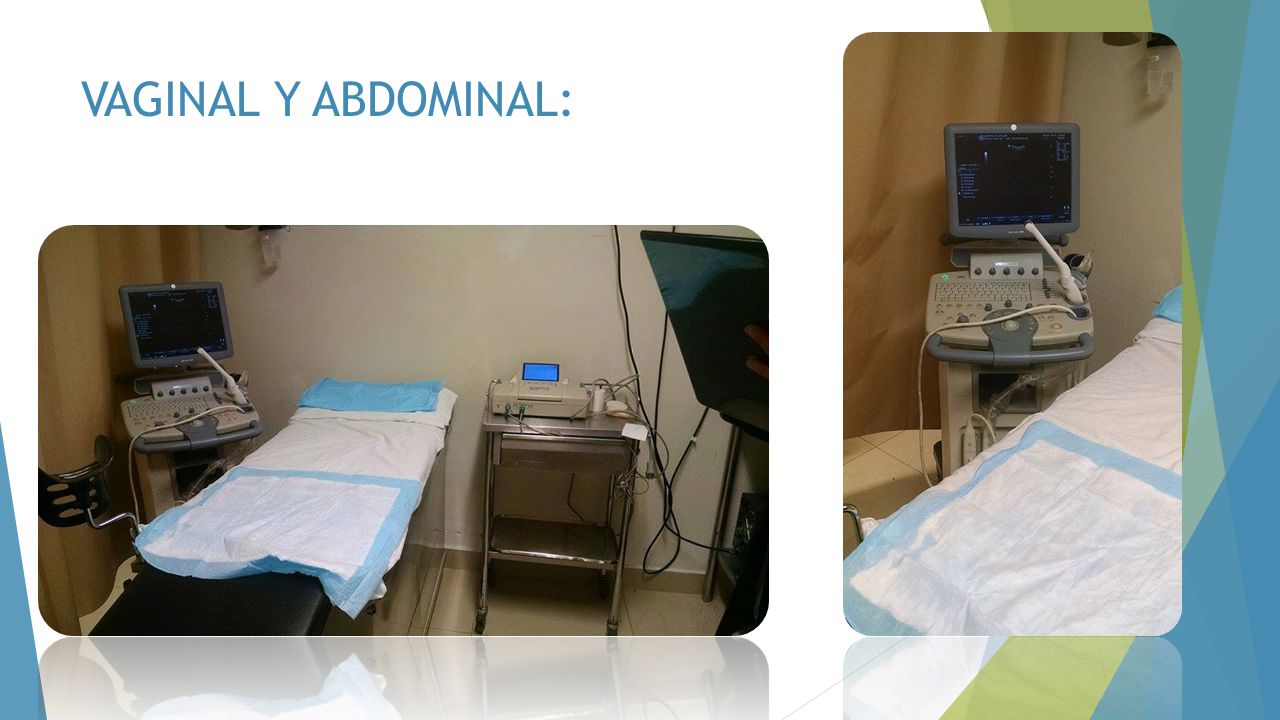 VAGINAL Y ABDOMINAL:
