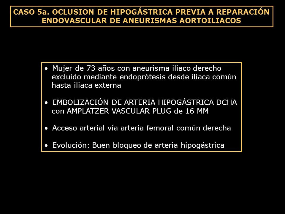 CASO 5a. OCLUSION DE HIPOGÁSTRICA PREVIA A REPARACIÓN ENDOVASCULAR DE ANEURISMAS AORTOILIACOS