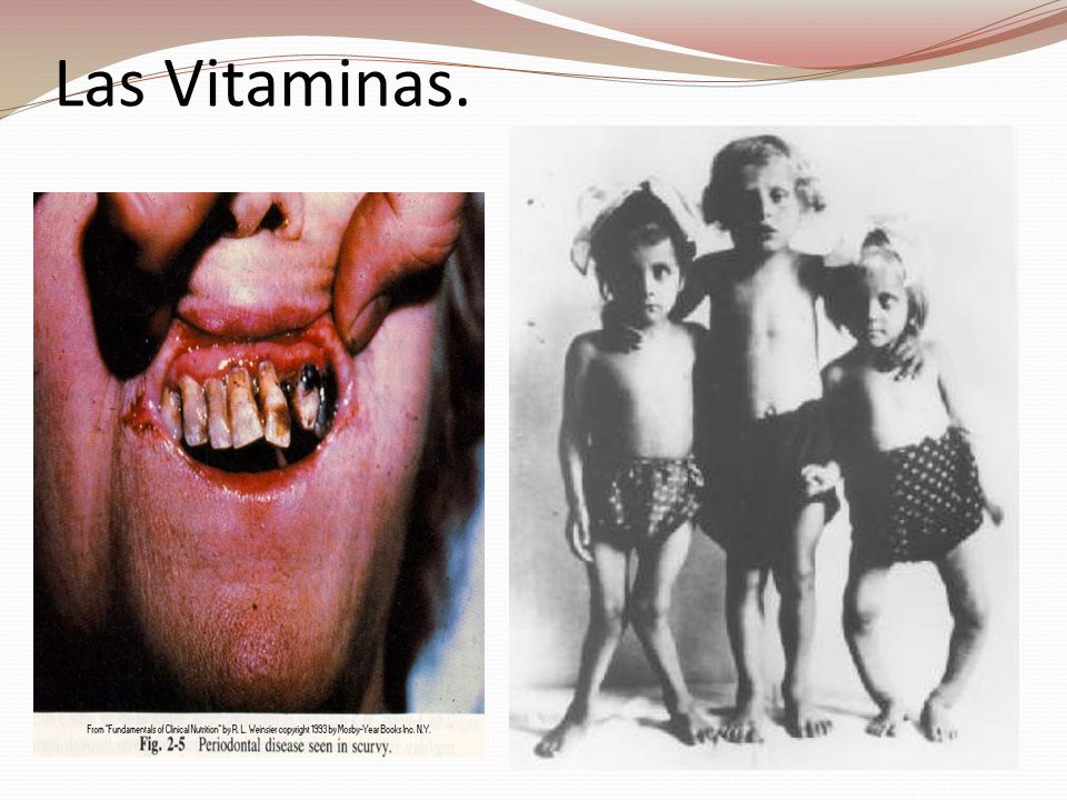 Las Vitaminas.