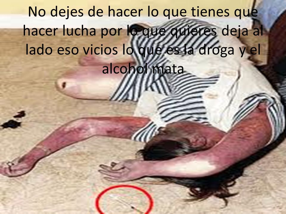 No dejes de hacer lo que tienes que hacer lucha por lo que quieres deja al lado eso vicios lo que es la droga y el alcohol mata