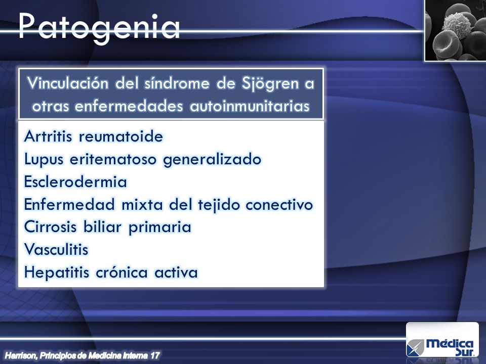 Patogenia Vinculación del síndrome de Sjögren a otras enfermedades autoinmunitarias. Artritis reumatoide.