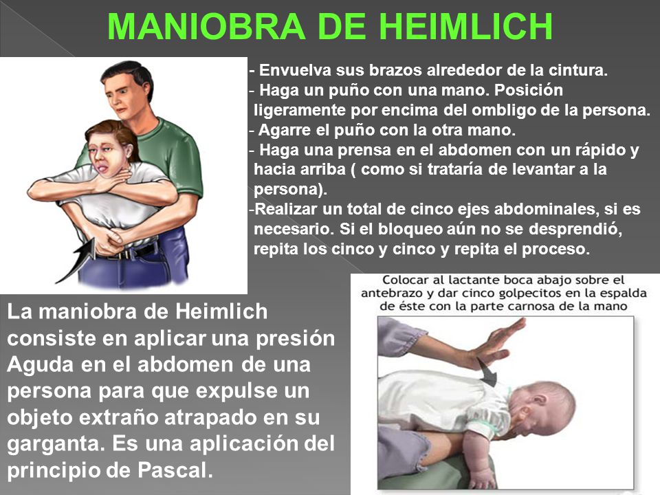 MANIOBRA DE HEIMLICH - Envuelva sus brazos alrededor de la cintura. Haga un puño con una mano. Posición.